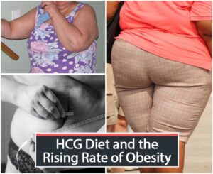 HCG Diet and the Rising Rate of Obesity
